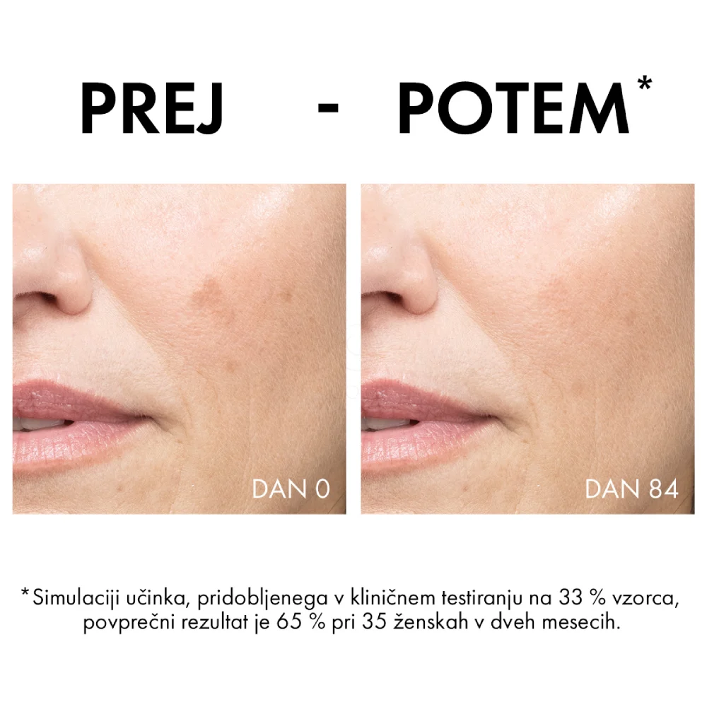 Vichy Liftactiv B3 Anti-Dark Spots, krema proti hiperpigmentacijskim madežem in gubam - ZF50 (50 ml)